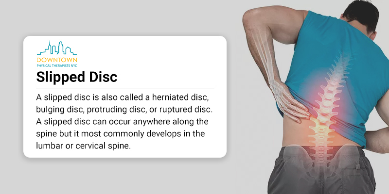 Slipped Disc