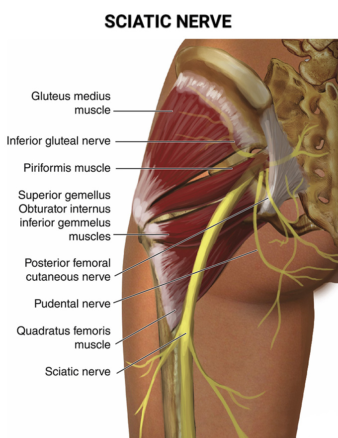 Sciatica and Sciatic Nerve Pain