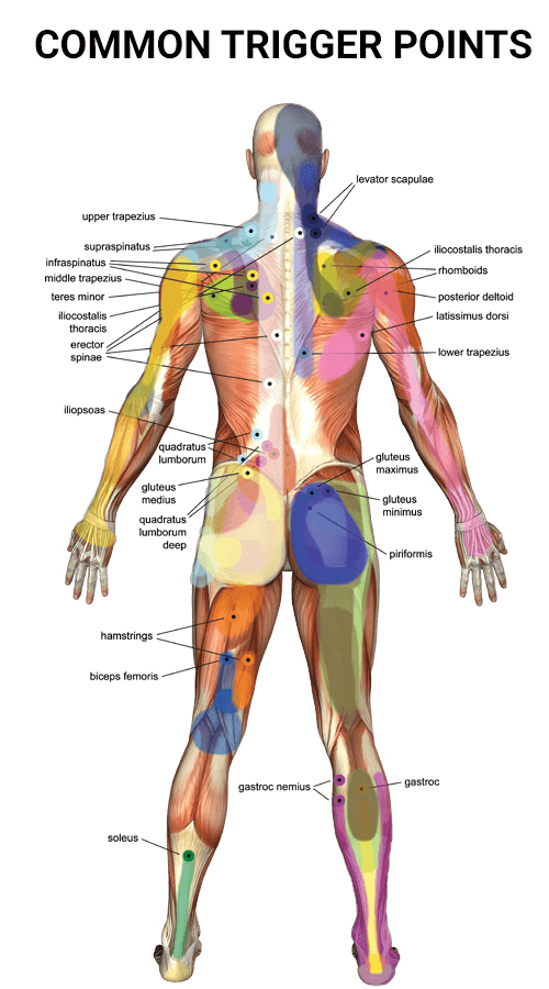 Massage Therapy for Trigger Points: What Physical Therapists Want You to  Know