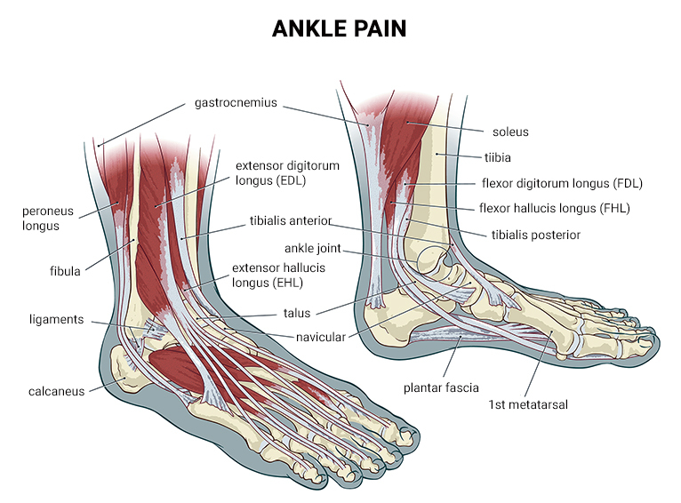 Ankle Pain