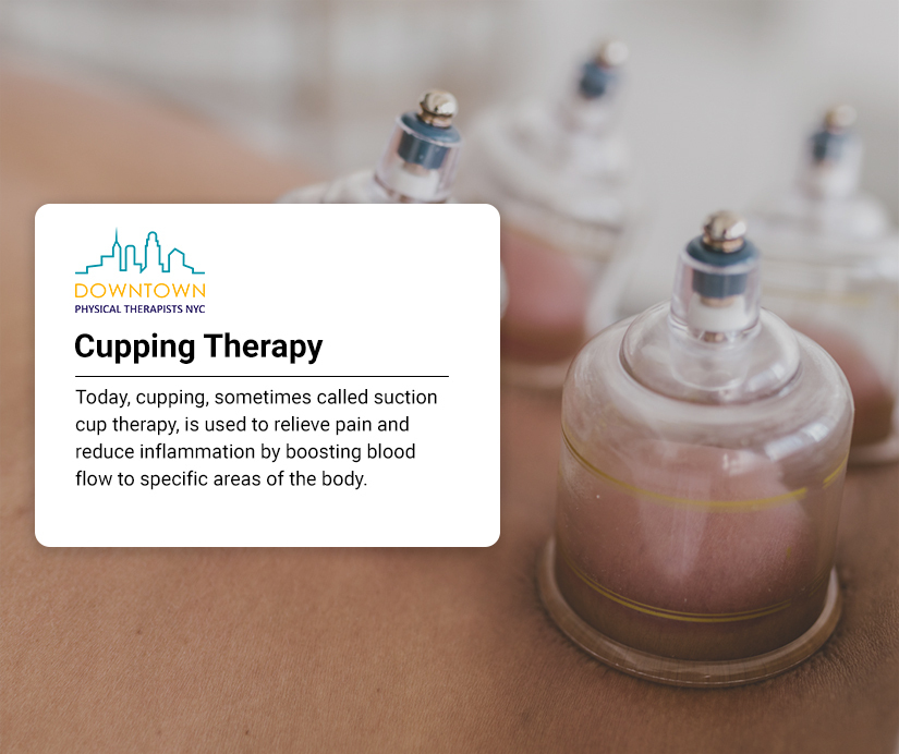 Cupping Therapy