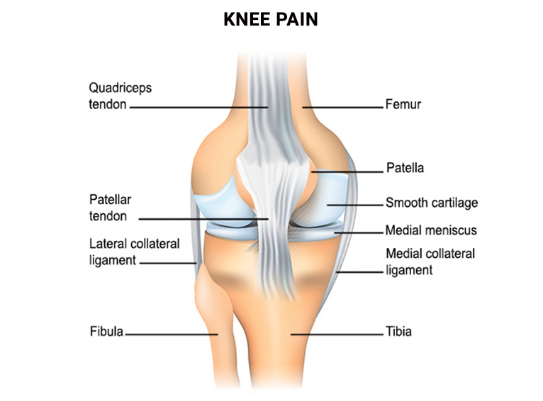 Patellar Tendonitis Treatment in NYC