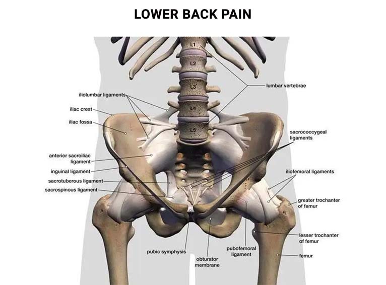 Lower back pain