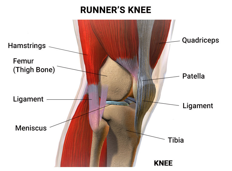 Runner’s Knee